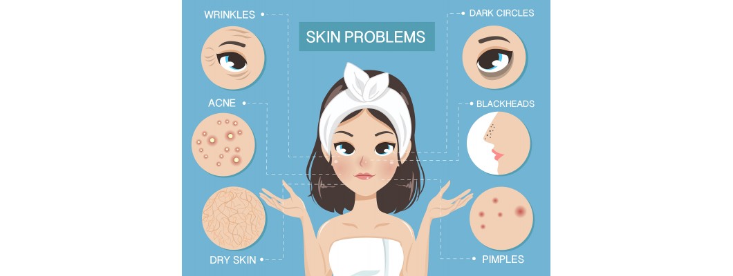 Skin Problem Solution Tips Skincare tips to prevent skin issues in the rainy season!